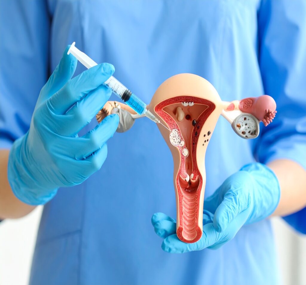 Womb and Fallopian Tube Treatment